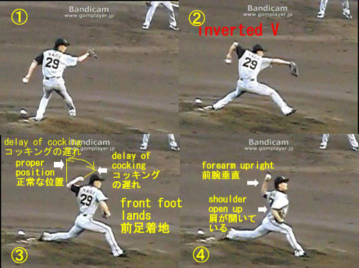 yagi tomoya inverted v 4frames520.jpg